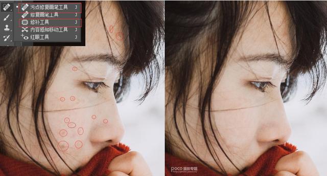 4种最常见的磨皮大法，我不说你还真不知道